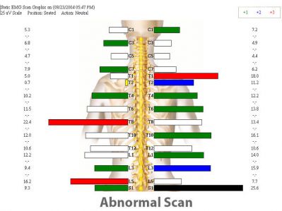 abnormalscanlg
