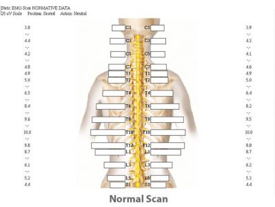 normalscanlg